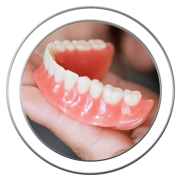 Removable denture model being held at J.P Prosthodontics in Fullerton, CA