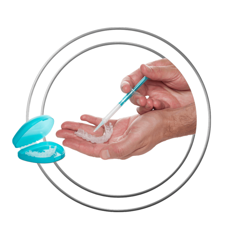 Professional teeth whitening kit used at J.P Prosthodontics in Fullerton, CA