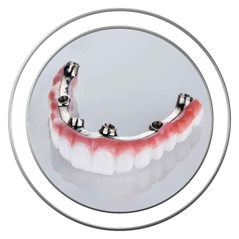 Stylized 3D model of a zirconia fixed dental bridge at J.P Prosthodontics in Fullerton, CA